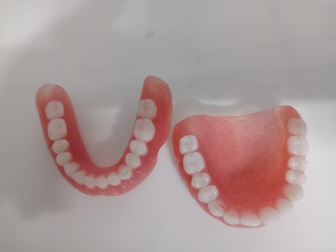 Denture full arch upper lower H621