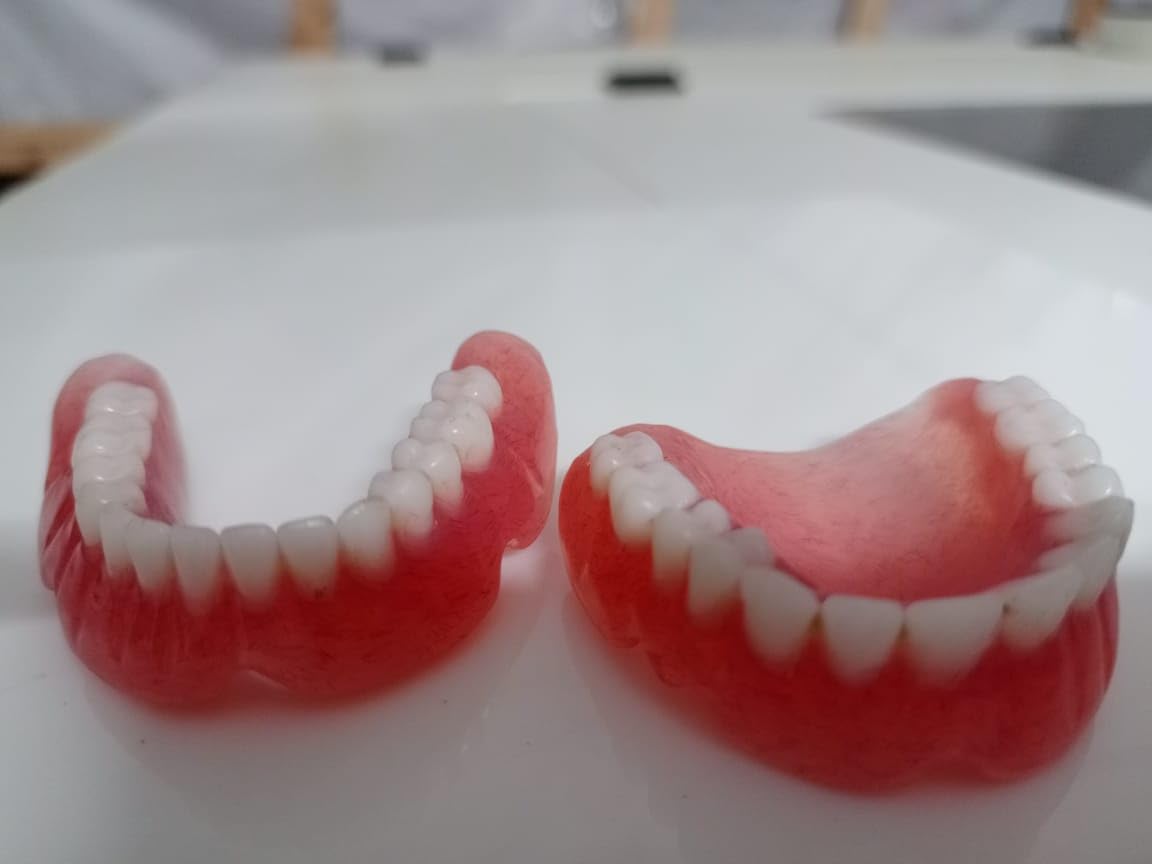 Denture full arch upper lower H621